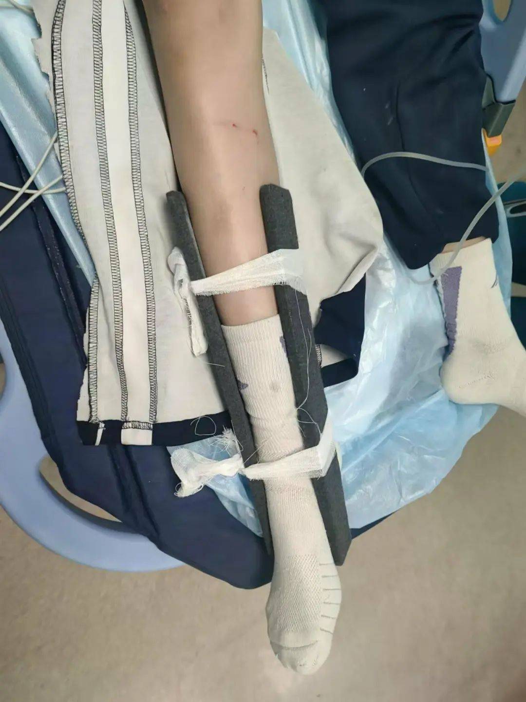 惨痛<strong></p>
<p>最值钱的虚拟币</strong>！一人身亡！深圳多名学生骑电动车发生意外