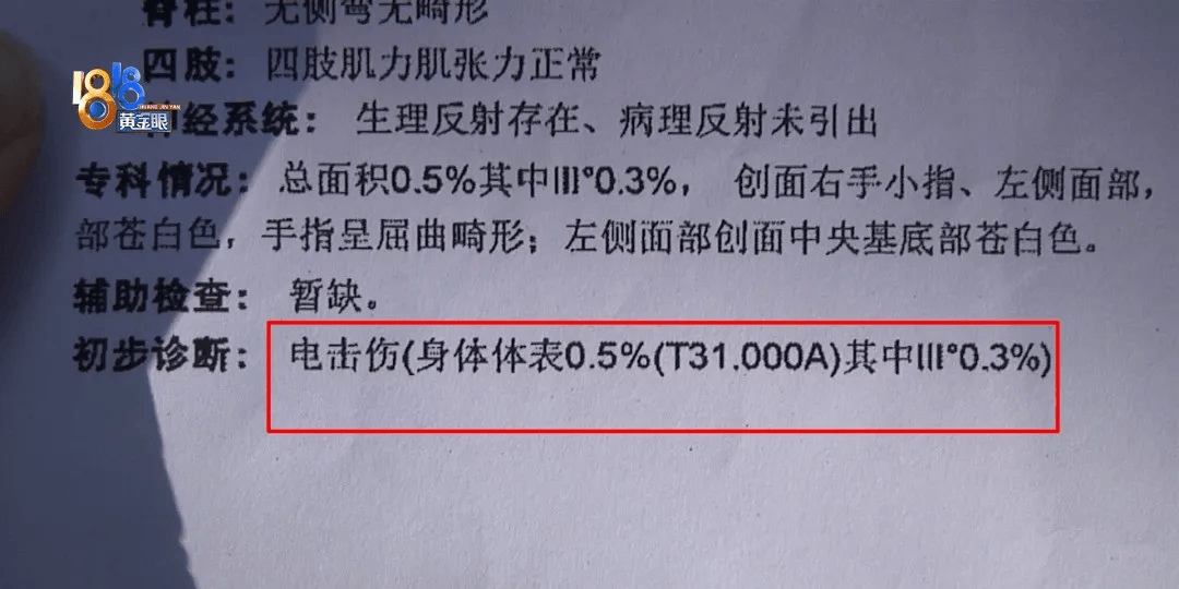5岁男童瞬间晕厥<strong></p>
<p>php虚拟币网站源码</strong>，筋都断了！街上常见，看见立即远离