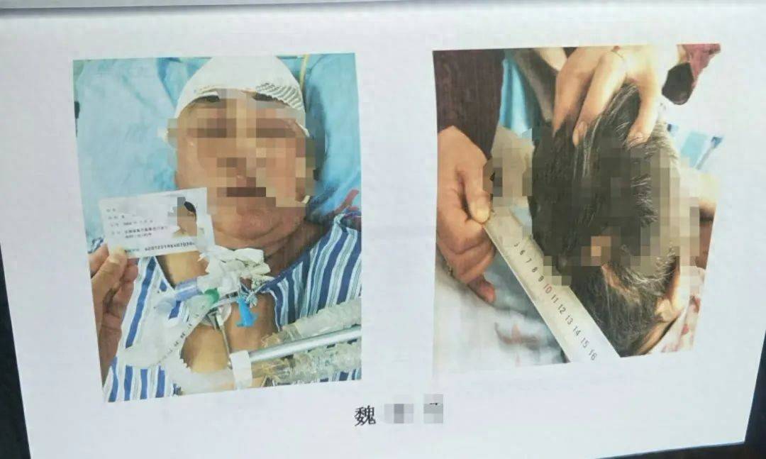 目睹母亲过马路被车撞<strong></p>
<p>中国首款虚拟币龙币</strong>，27岁女子受惊吓5天后身亡