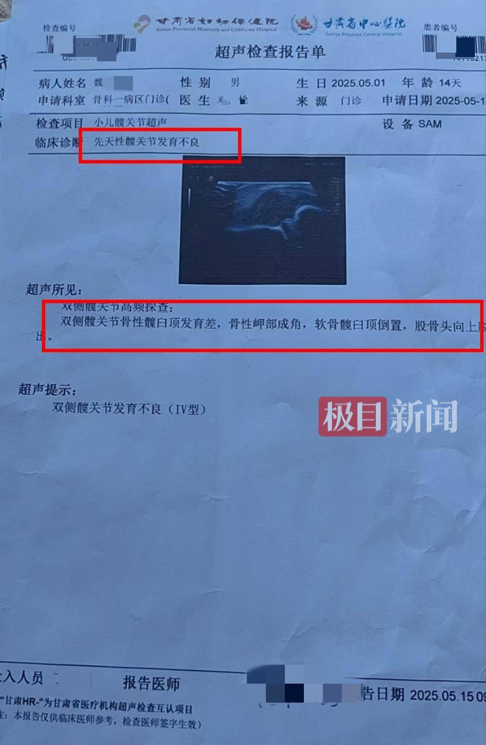 二胎出生查出先天性病症或落下残疾<strong></p>
<p>原油招聘</strong>,残疾父母称医院产检漏检、未尽告知义务,医院及医调委回应