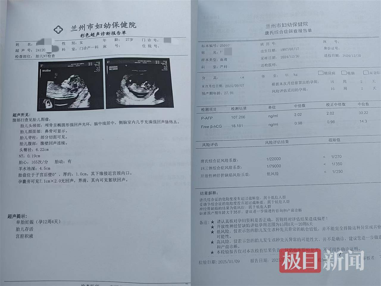 二胎出生查出先天性病症或落下残疾<strong></p>
<p>原油招聘</strong>,残疾父母称医院产检漏检、未尽告知义务,医院及医调委回应