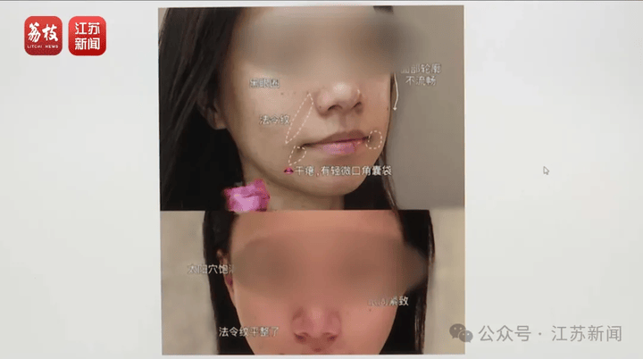 打一针“返老还童”的童颜针卖了30亿<strong></p>
<p>原油含水测定仪</strong>，真的有效吗？