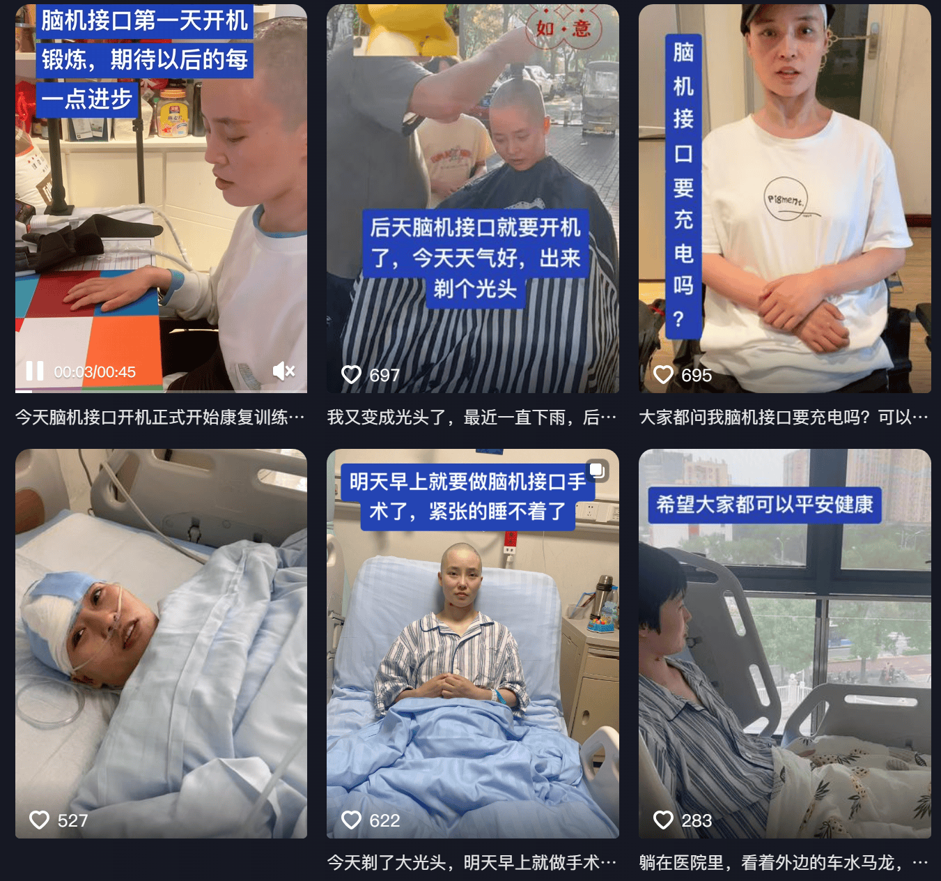 女子因车祸全身瘫痪6年仅嘴眼能动<strong></p>
<p>原油</strong>,接受脑机接口手术后通过意念抓取物品!当事人讲述