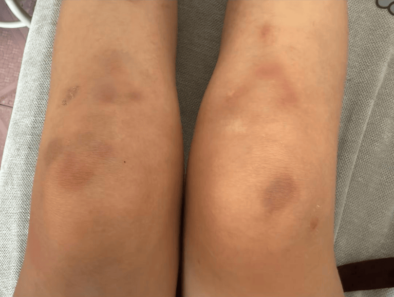 女子自称因工资问题被老板锁办公室里打 警方:双方已到派出所<strong></p>
<p>凤凰卫视资讯台节目表</strong>,是否打人还在调查