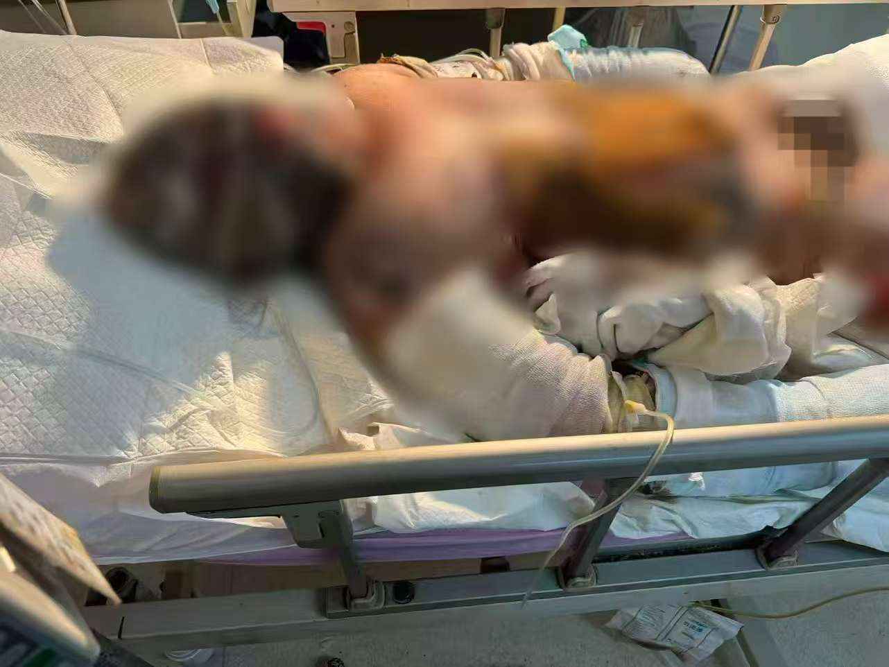 父子在哈尔滨一亲戚公司上班遇爆炸全身烧伤<strong></p>
<p>世界电影之旅</strong>,治疗花费近百万公司拒赔偿?亲戚回应