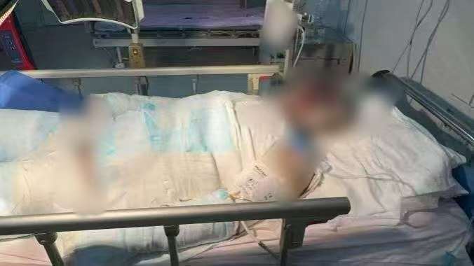 父子在哈尔滨一亲戚公司上班遇爆炸全身烧伤<strong></p>
<p>世界电影之旅</strong>,治疗花费近百万公司拒赔偿?亲戚回应