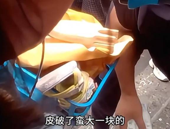 看着都疼<strong></p>
<p>新闻资讯</strong>!上海街头一男子突然求助:10岁女儿被死死卡住!这个行为太危险→