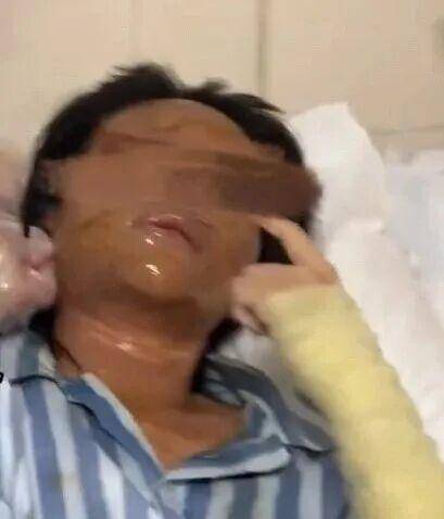 湖南一女主播被伪装的包裹炸伤<strong></p>
<p>新闻资讯</strong>,永州公安:正在核实具体情况