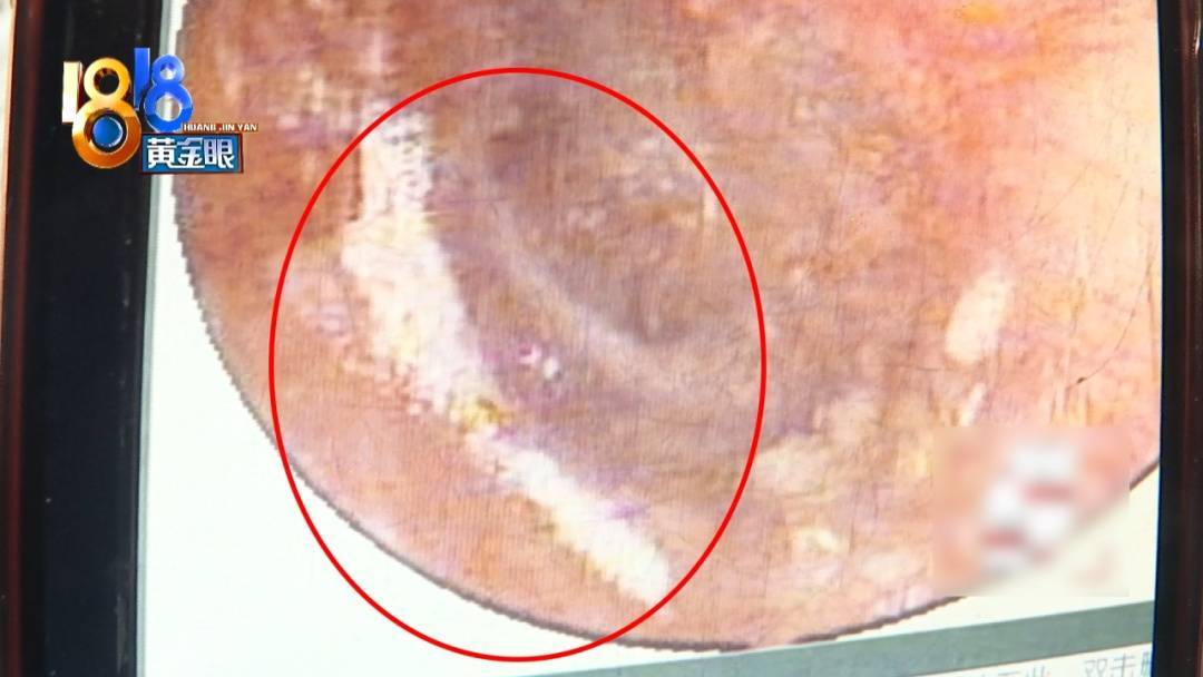 杭州姑娘痒了一整夜<strong></p>
<p>资讯点</strong>,检查结果让她崩溃……浴场回应索赔:凭什么要两千?